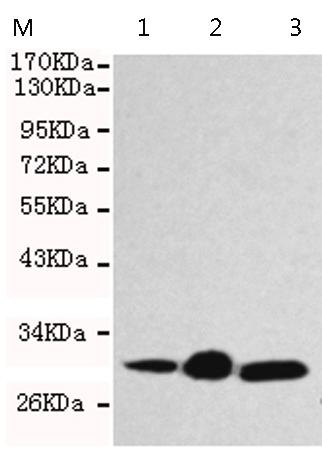 小鼠抗CBR1单克隆抗体   