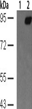 兔抗STAT1 (Phospho-Tyr701)多克隆抗体 