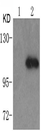 兔抗STAT2 (phospho-Tyr690)多克隆抗体