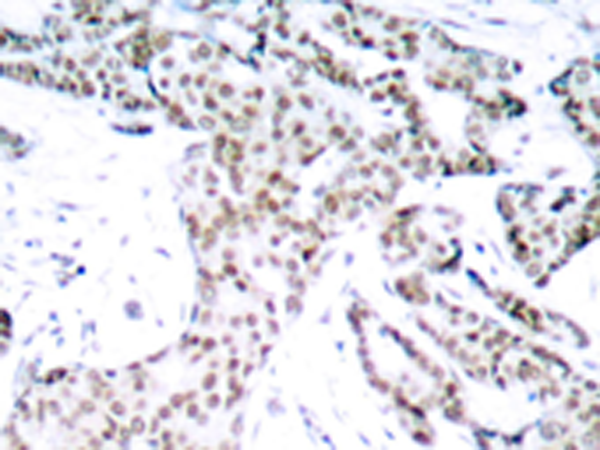 兔抗STAT3 (Phospho-Ser727)多克隆抗体