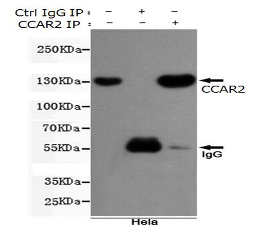 小鼠抗CCAR2单克隆抗体    