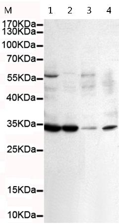  小鼠抗CDK1单克隆抗体  