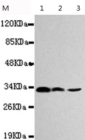 小鼠抗CDK4单克隆抗体 