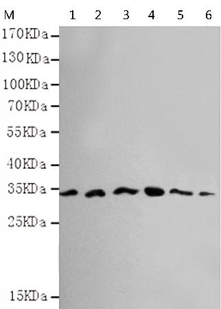小鼠抗CDK5(N-term)单克隆抗体 