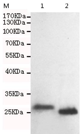 小鼠抗CDKN1B单克隆抗体  