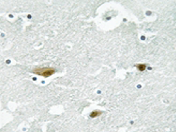兔抗STK39(Phospho-Ser325) 多克隆抗体