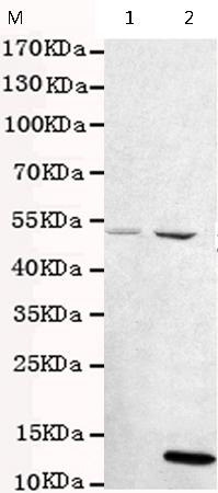 小鼠抗CHRDL1单克隆抗体   