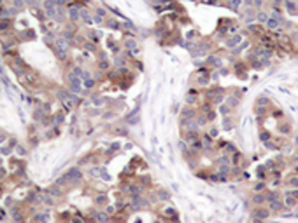 兔抗STMN1 (Phospho-Ser25)多克隆抗体