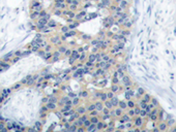 兔抗STMN1 (Phospho-Ser38)多克隆抗体