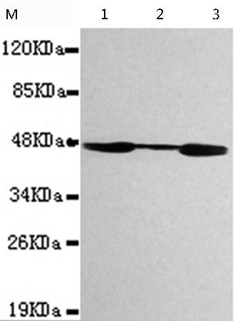 小鼠抗CKMT1B单克隆抗体 
