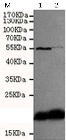 小鼠抗CXCL8单克隆抗体  