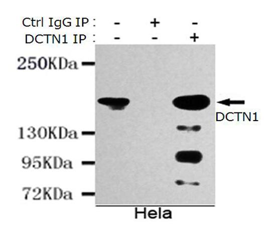 小鼠抗DCTN1(N-term)单克隆抗体   