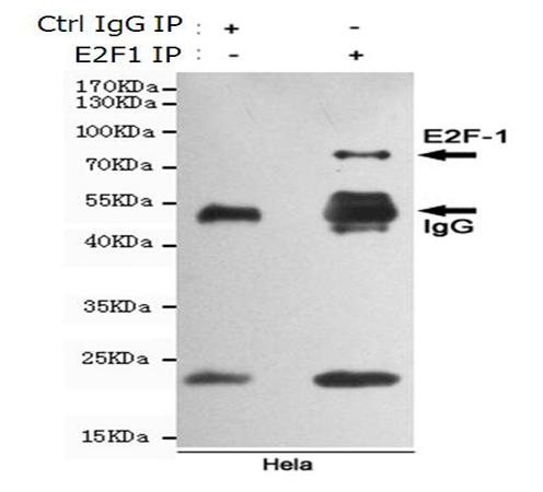 小鼠抗E2F1单克隆抗体   