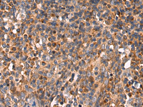 兔抗LRP1多克隆抗体 