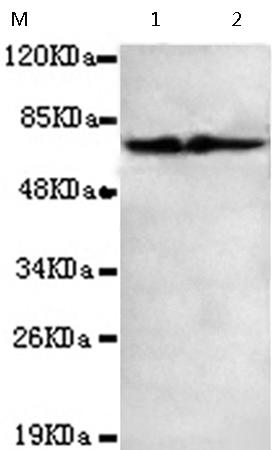 小鼠抗FOXO1(C-term)单克隆抗体  
