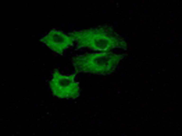 兔抗LY6E多克隆抗体