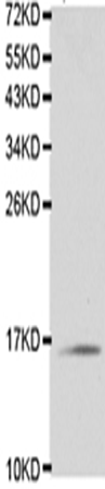 兔抗TCL1A多克隆抗体