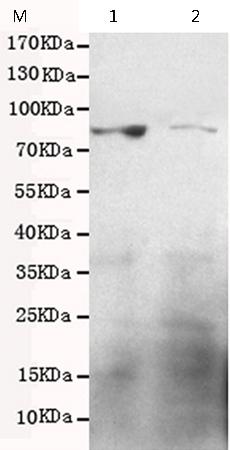 小鼠抗GRK2单克隆抗体  