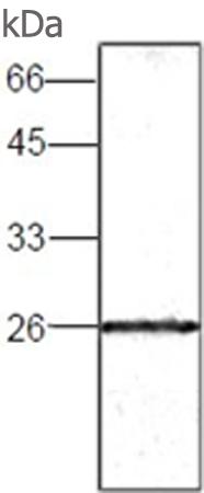 小鼠抗GSTO1单克隆抗体  