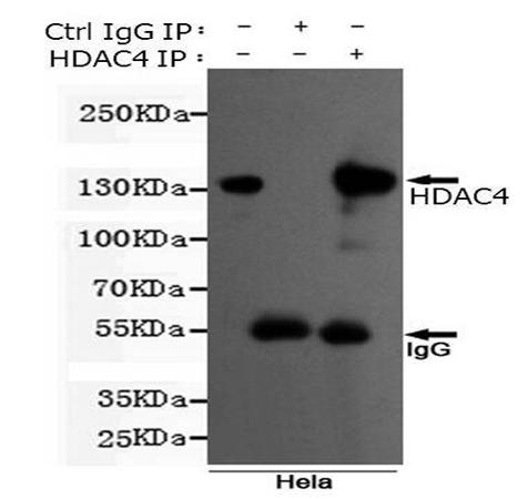 小鼠抗HDAC4(N-term)单克隆抗体 