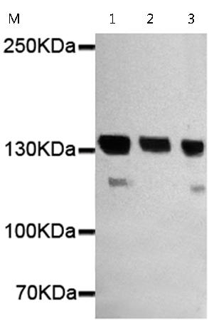 小鼠抗HDAC4(N-term)单克隆抗体 