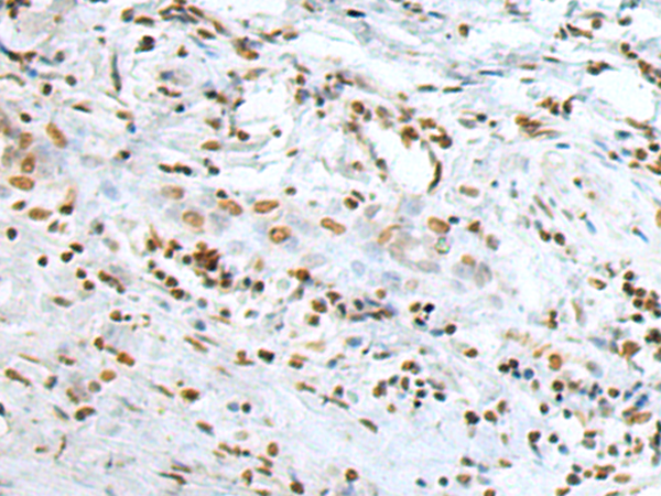 小鼠抗PARP1(Cleaved)单克隆抗体