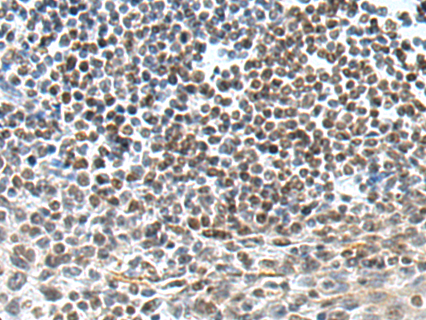 小鼠抗PARP1(Cleaved)单克隆抗体