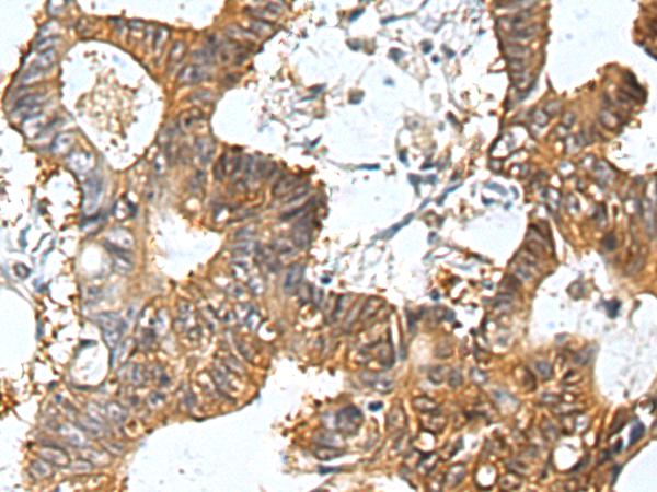 小鼠抗HSP90AA1单克隆抗体 