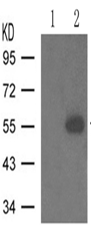 兔抗TH (Phospho-Ser31)多克隆抗体