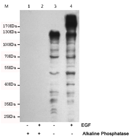 小鼠抗Phospho-Tyrosine单克隆抗体 