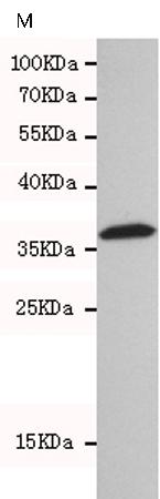 小鼠抗HTRA2单克隆抗体   