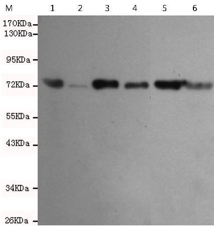 小鼠抗IGF2BP3单克隆抗体  