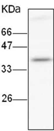 小鼠抗ITLN1单克隆抗体  