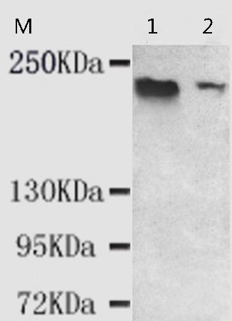 小鼠抗KDM5C单克隆抗体   