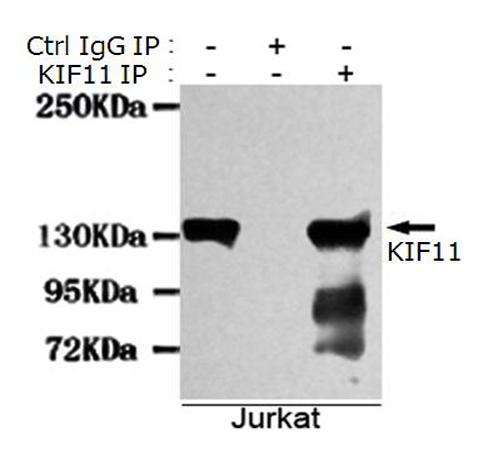 小鼠抗KIF11单克隆抗体  