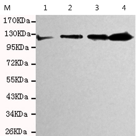 小鼠抗PPP1R18单克隆抗体  