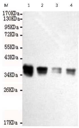 小鼠抗PPP2CA/PPP2CB单克隆抗体