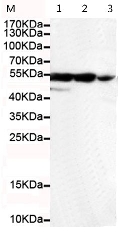 小鼠抗KRT7(C-term)单克隆抗体   
