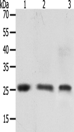兔抗TIMP4多克隆抗体