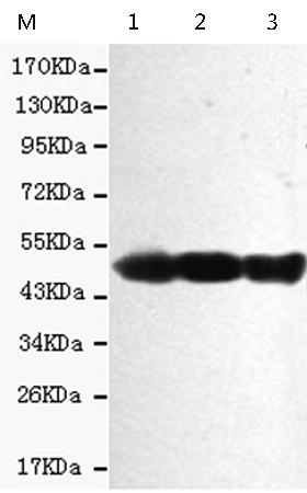 小鼠抗KRT18单克隆抗体   