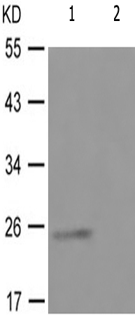 兔抗TK1(Phospho-Ser13) 多克隆抗体