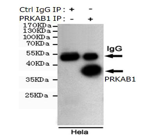 小鼠抗PRKAB1单克隆抗体