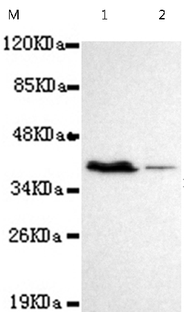 小鼠抗PRMT6单克隆抗体