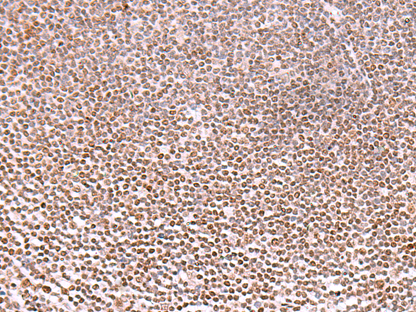 兔抗TMEM18多克隆抗体 