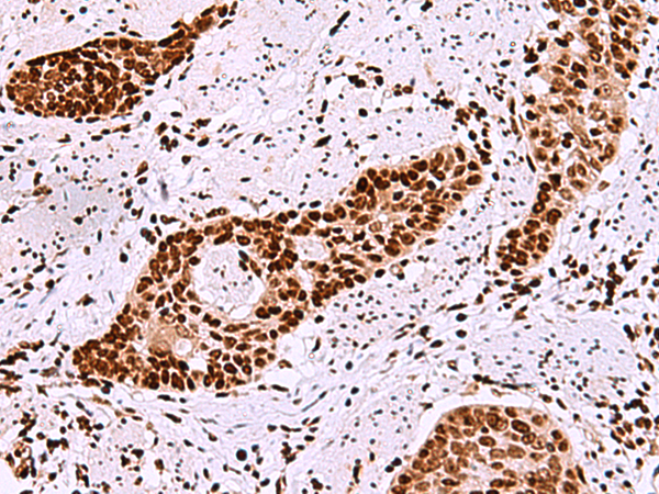 兔抗TMEM18多克隆抗体 