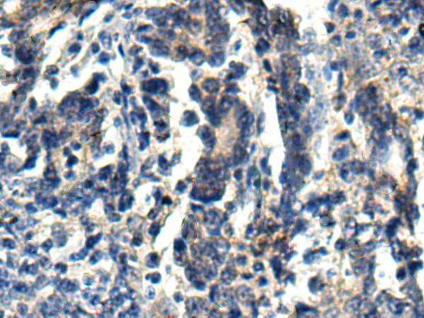 小鼠抗MAP1LC3A单克隆抗体