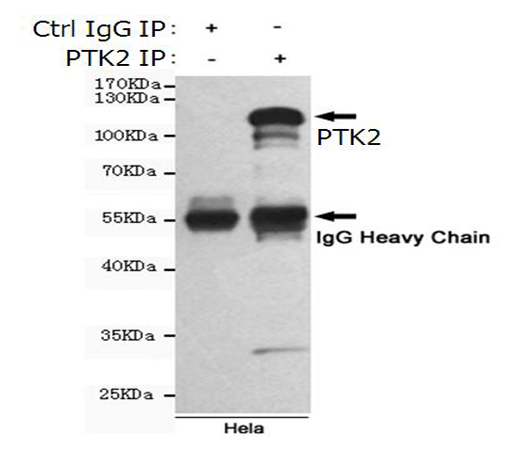 小鼠抗PTK2单克隆抗体 