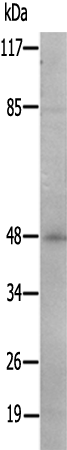 兔抗TMEM237多克隆抗体 