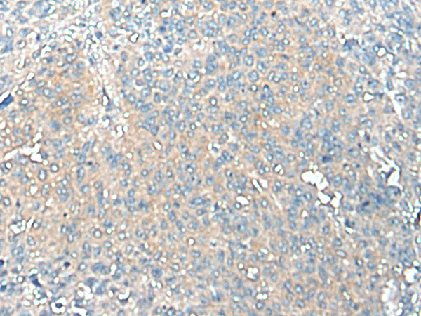兔抗TMEM256多克隆抗体