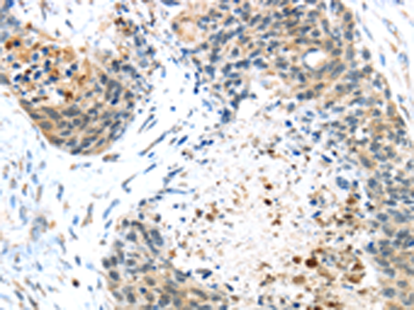 兔抗TMPRSS4多克隆抗体